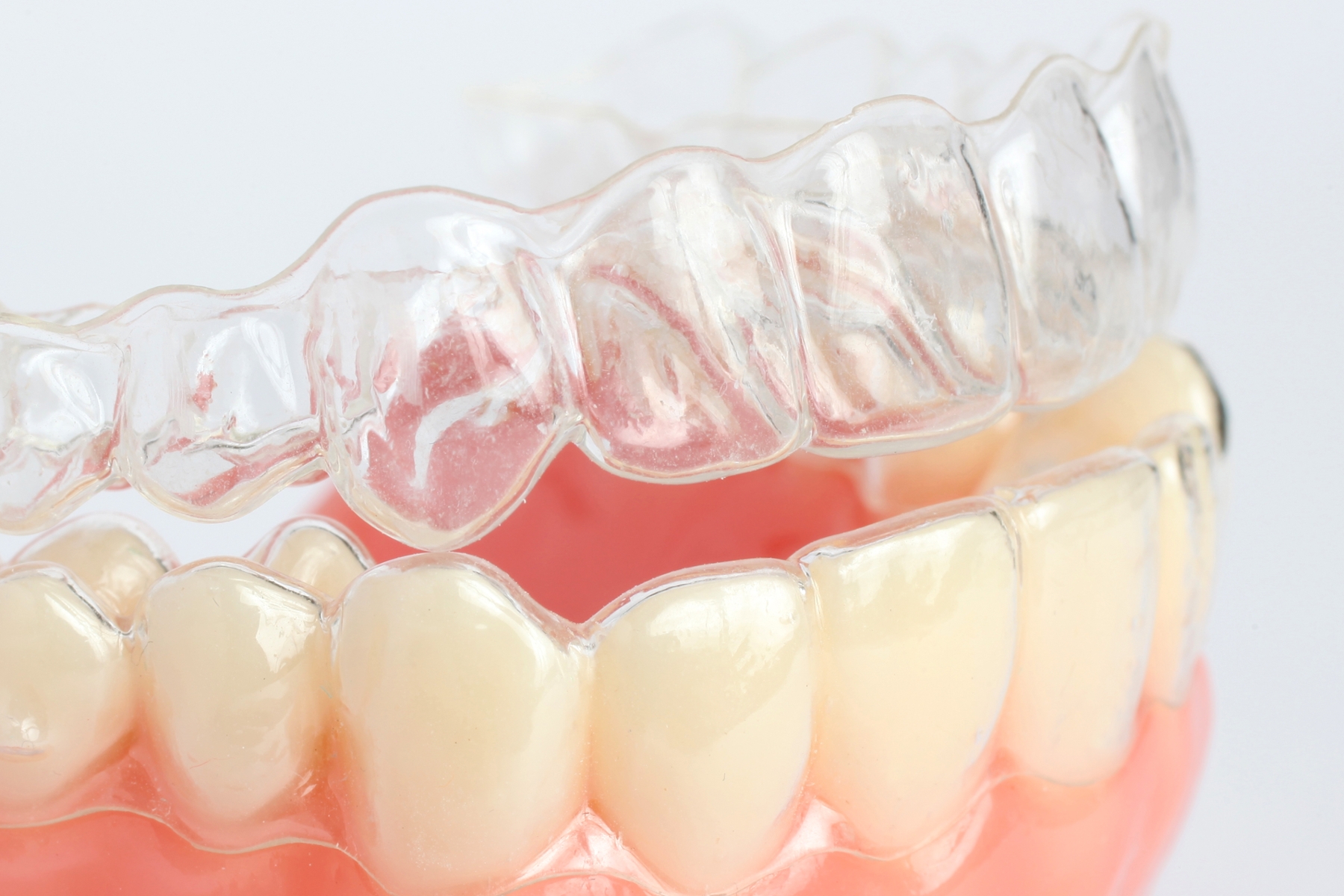 close up of clear aligner on bottom teeth | invisalign mesquite tx