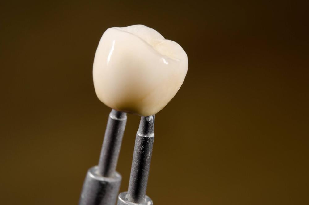 tooth crown in mesquite tx