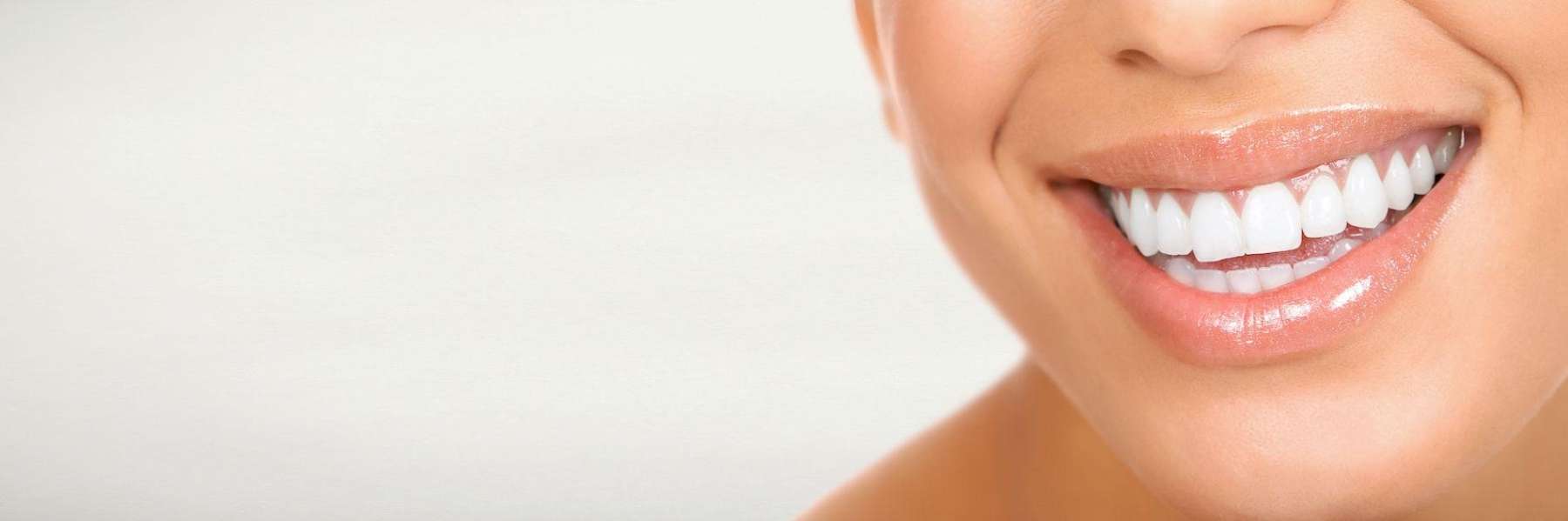 close up of bright smile | dentist mesquite tx