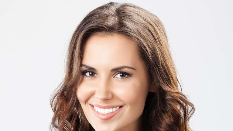 woman smiling after getting veneers 