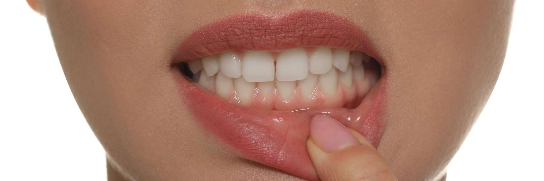 patient showing swollen gums | gum disease prevention mesquite tx