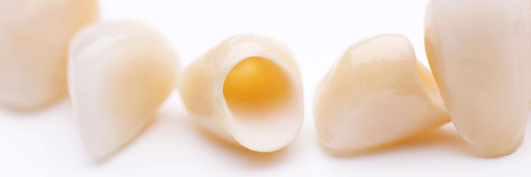 dental crowns in mesquite tx